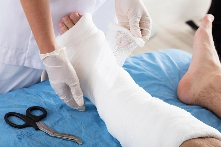 Podiatrist wrapping foot cast for injury treatment and custom orthotics support at Precision Podiatry in Alma