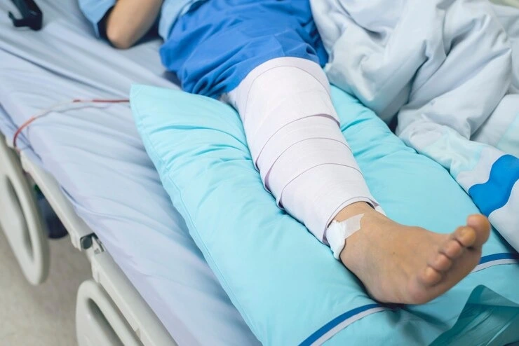 Patient recovering with lower leg medical wrap for podiatric treatment at Precision Podiatry in Alma
